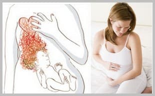 Как бороться с изжогой в период беременности